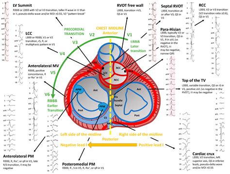 localization of pvcs.